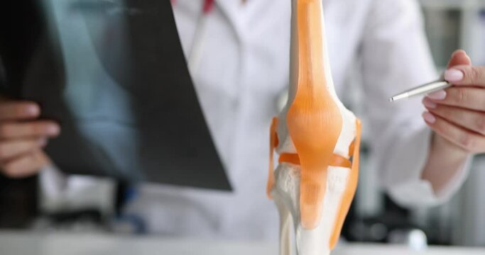 X-ray image and leg injury rheumatologist consultation