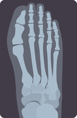 Foot X-ray Illustration