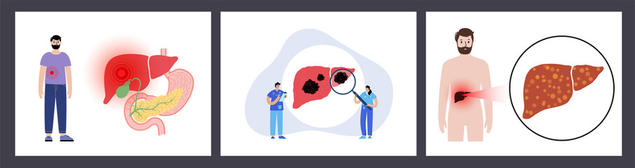Liver disease concept