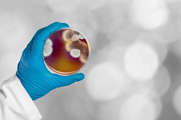 Petri dish hold in hand wears nitrile glove for cultivate yeast, in medical health laboratory analysis. Penicillium in dish