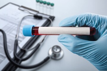 Blood tube for test detection of virus Covid-19 Omicron Variant on papers document.
