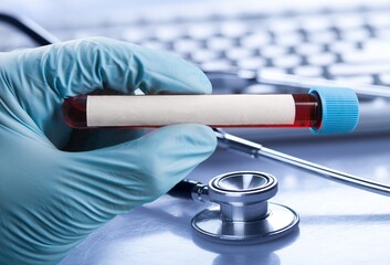 Blood tube for test detection of virus Covid-19 Omicron Variant on papers document.