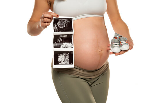 Pregnant woman with ultrasound scan pictures and pair of gray baby sneakers on a white background