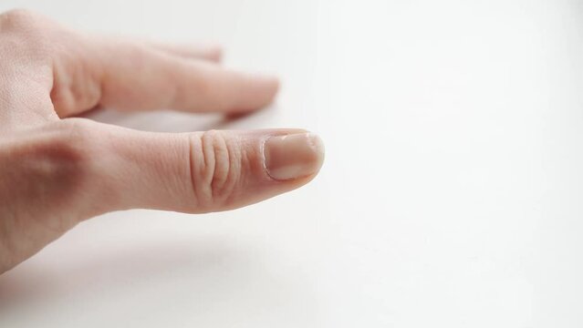 Close up of brittle nails on woman hand. White background. Brocken and dry fingernail. Avitaminosis and micro elements deficits 