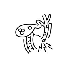 Chronic cholecystitis color line icon. Human diseases.