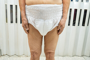 Asian senior or elderly old lady woman patient wearing incontinence diaper in nursing hospital ward, healthy strong medical concept.