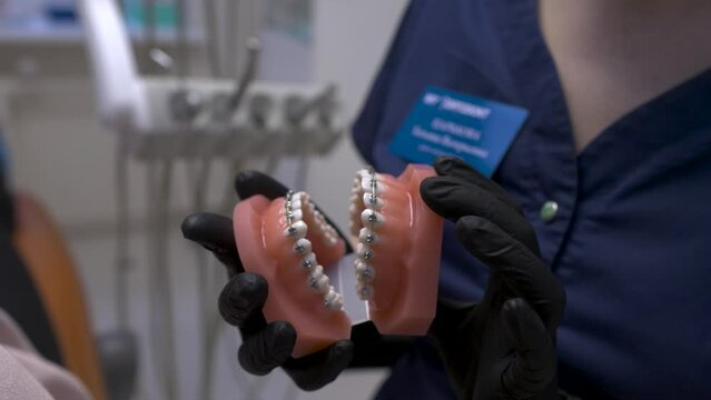 jaw model of ceramic teeth with bracket system in hands of doctor