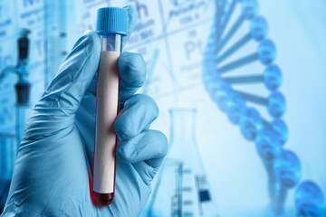 Hand holding a test tube with patient's blood for testing