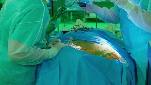 performing a medical operation in the operating room. hands of a surgeon, an assistant and a nurse close-up. the surgeon gives the nurse an instrument