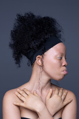 portrait of an albino woman with black hair