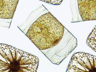 Algae under microscopic view, Chrysophyte, diatoms, phytoplankton, fossils, silica, golden yellow...
