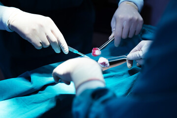 Asian Surgical Team Performing Surgery in the Hospital Operating Room