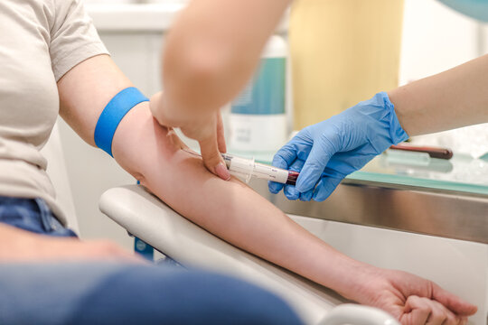 Close-up Of Doctor Taking Blood Sample From Patient's Arm in Hospital for Medical Testing.