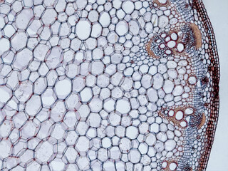 plant stem (dahlia stem) cross section under the microscope showing epidermis, bascular bundles...