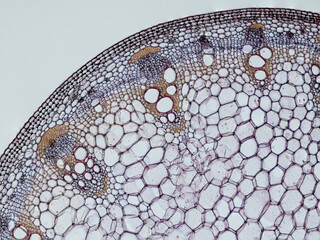 plant stem (dahlia stem) cross section under the microscope showing epidermis, bascular bundles...