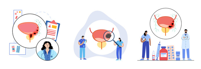 Bladder cancer stages