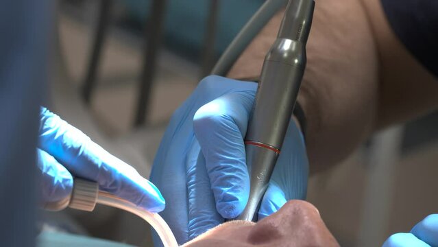 Professional dentist drills tooth an assistant holds salivating pump. with sound