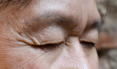 Wrinkles around closed eye of Asian elder man.