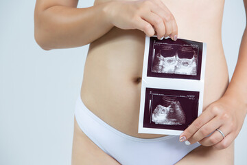 pregnant woman holding ultrasound image concept of pregnancy