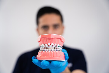 Dentista sujetando modelo de dentadura con brackets. Enfoque close-up de material didáctico dental...