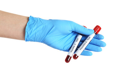 Scientist holding tubes with blood samples for hepatitis virus test on white background, closeup