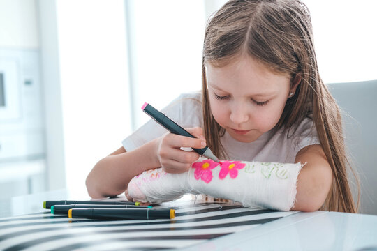 A little girl paints a cast on her arm. A child draws a drawing on a cast after a hand injury.