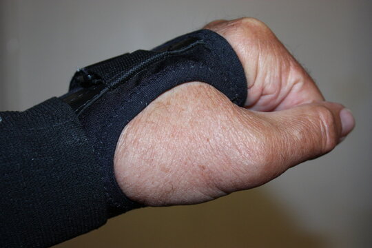 Nahaufnahme einer linken Hand mit Handgelenkorthese