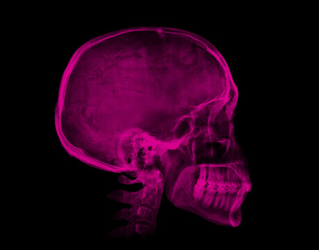 Human skull. Pink X-ray image on black background