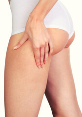 Young woman in underwear squeezing skin to show cellulite and stretch marks isolated on white...