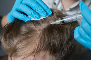 Injection plasma into head hair man cosmetologist doctor.