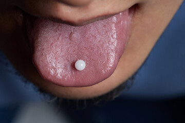 Man taking pill, mouth open with tongue sticking out.