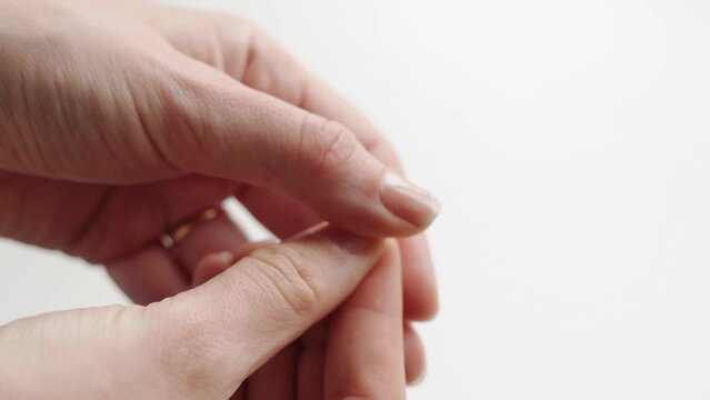 Close up of brittle nails on woman hand. White background. Brocken and dry fingernail. Avitaminosis and micro elements deficits 