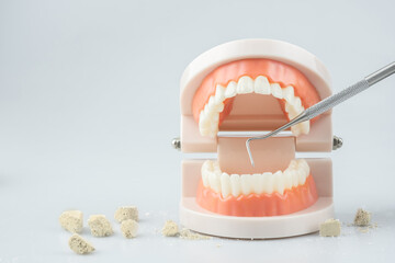 Teeth model with dental plaque tool ,Concept Dental care cleaning bacterial plaque and scaling...