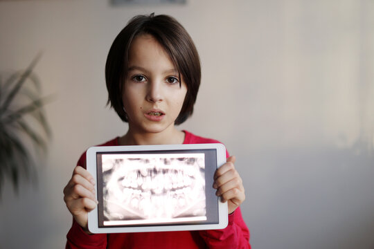 Child, wearing braces, preteen boy, holding tablet with a picture of his x-ray teeth from the dentistof him