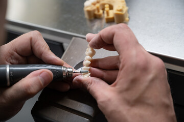 fabrication de dentier © Esta Webster
