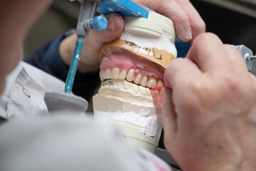 création d'un dentier