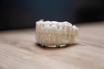 Dentier © Esta Webster