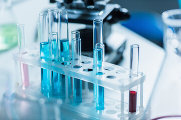 test tubes with liquid in chemical laboratory on blurred background.