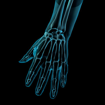 Close-up of an x-ray image of a human hand