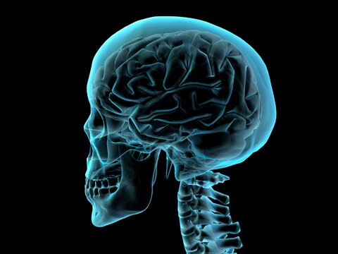 X-ray image of a human skull