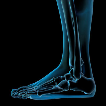 Side profile of an x-ray image of a human leg