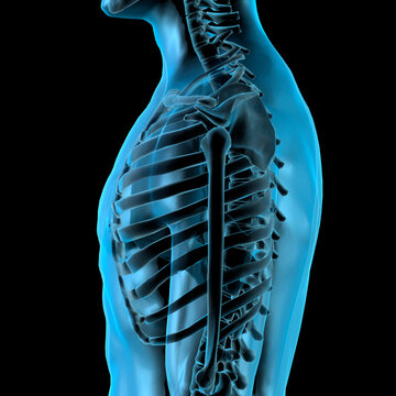X-ray of human ribs