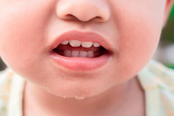 Fototapeta premium Mouth and milk teeth of a 2-year-old child