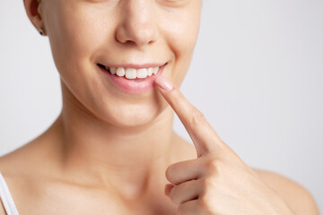 Obraz na płótnie Canvas Beautiful female smile after teeth whitening procedure.