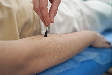 Neurologist is checking male patient sensitivity in office