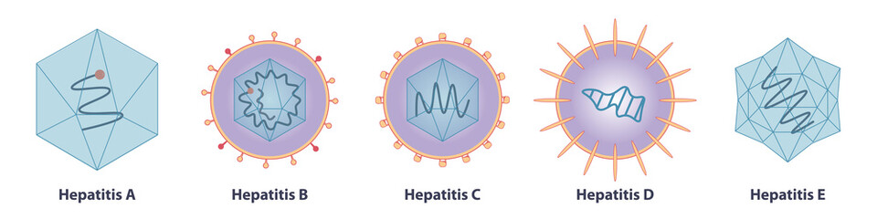 Five main types of viruses cause hepatitis: hepatitisviruses A (HAV), B (HBV), C (HCV), D, (HDV) and E (HEV)