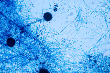 Aspergillus niger and Aspergillus oryzae  (mold) under microscope for Microbiology in Lab.
