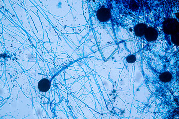 Aspergillus niger and Aspergillus oryzae  (mold) under microscope for Microbiology in Lab.
