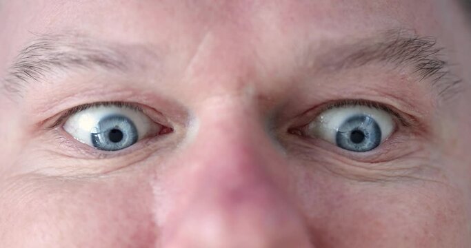 Man with blue eyes does gymnastics for eyes closeup