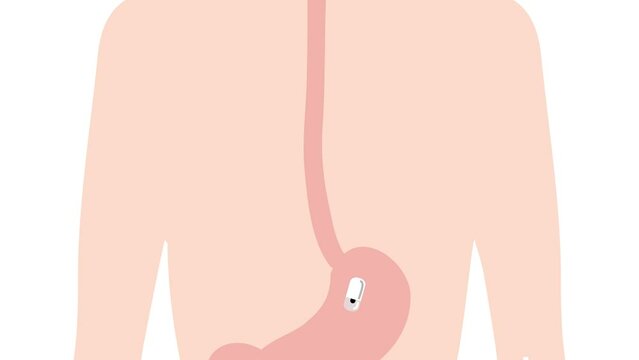 胃カメラ　検査　（カプセル）　アニメーション動画